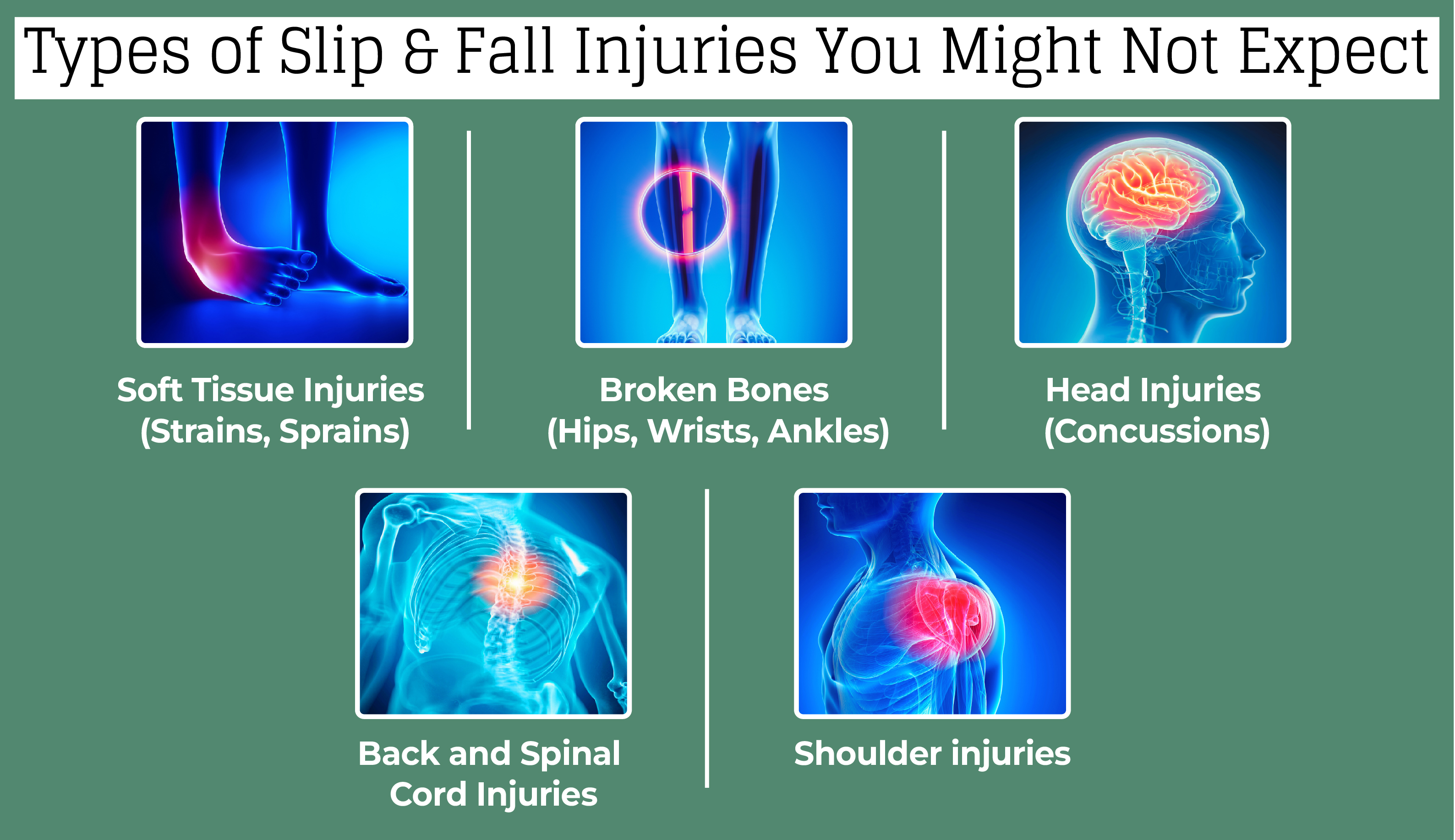 Slip and Fall Injuries