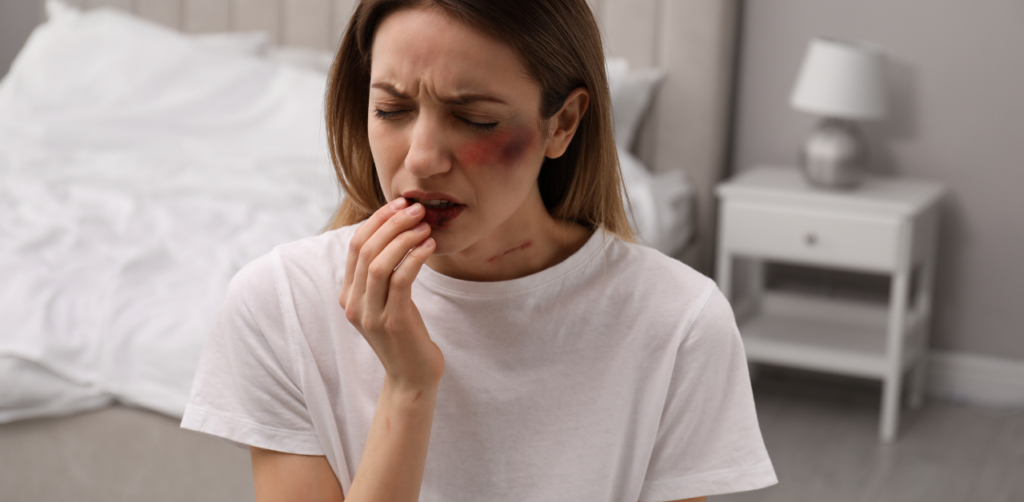 Distressed woman with bruises on her face and scratches on her neck touches her lip while sitting in a bedroom with a bed and nightstand in the background
