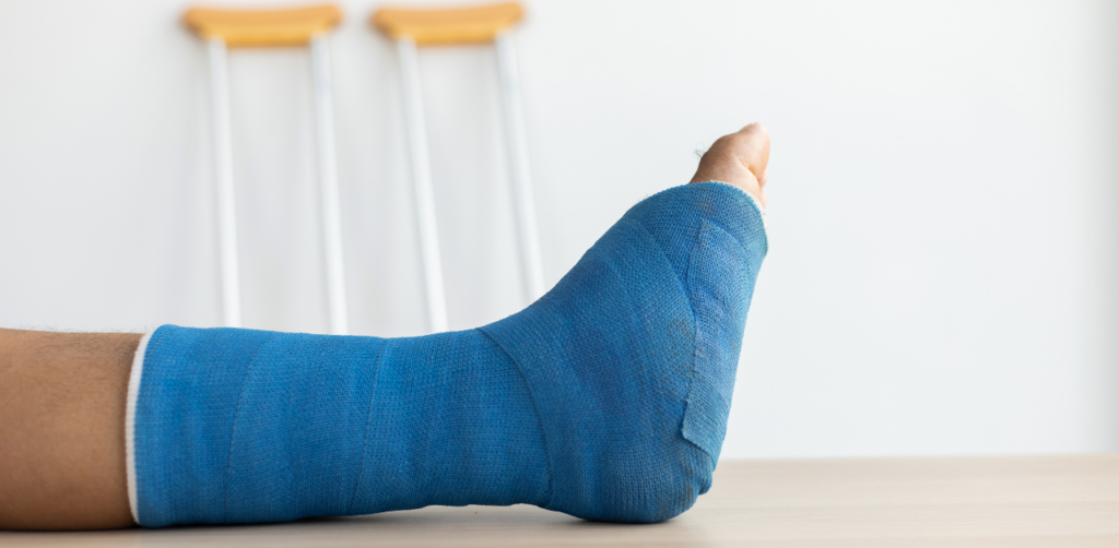 Foot in a blue cast rests on a table, with a pair of crutches leaning against a white wall in the background