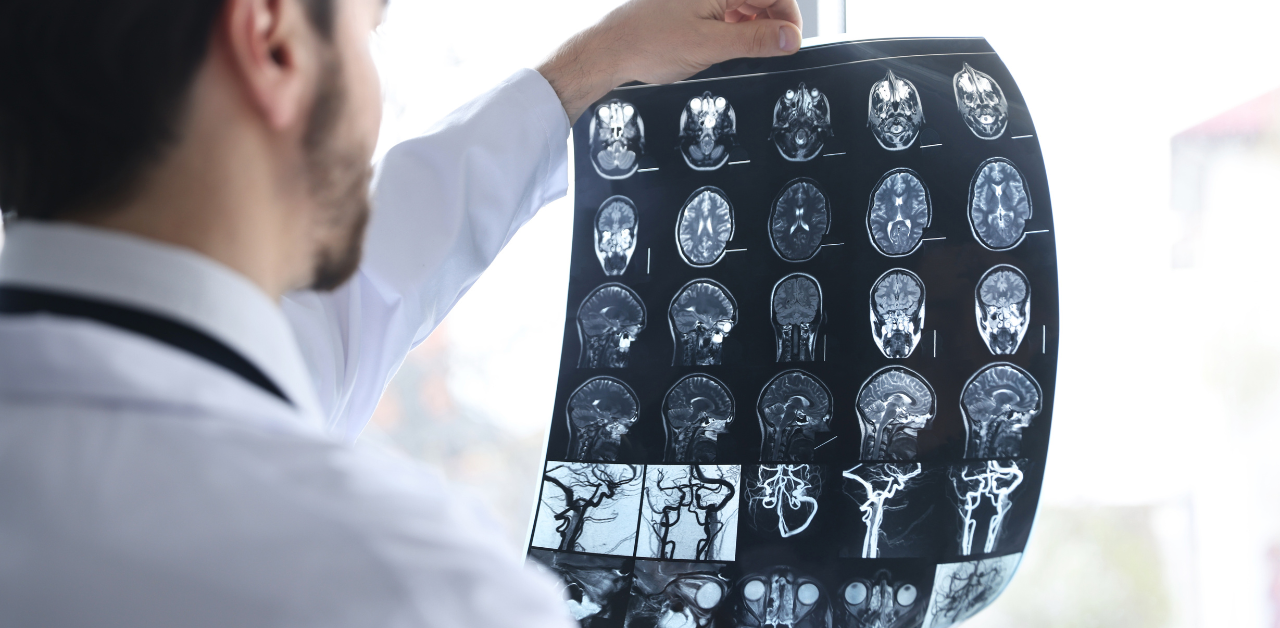 Doctor reviewing brain MRI scans for diagnosis and treatment planning